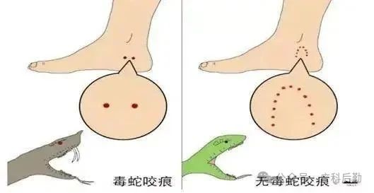 應(yīng)急小常識 | 進(jìn)入高發(fā)季！如何防蛇自救？